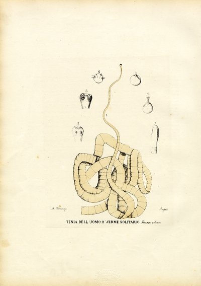Tape Worm, 1863-79 by Raimundo Petraroja